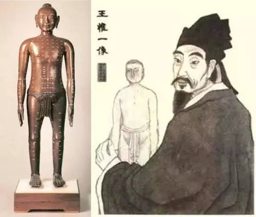 王惟一發(fā)明并鑄造<em>針灸</em><em>銅人</em>