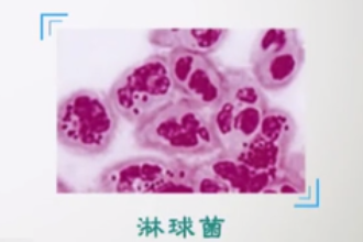 什么是淋??？